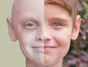 Η 15η Φεβρουαρίου είναι η Παγκόσμια Ημέρα κατά του Παιδικού Καρκίνου
